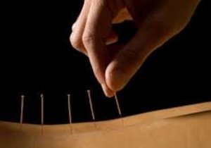What is Acupuncture